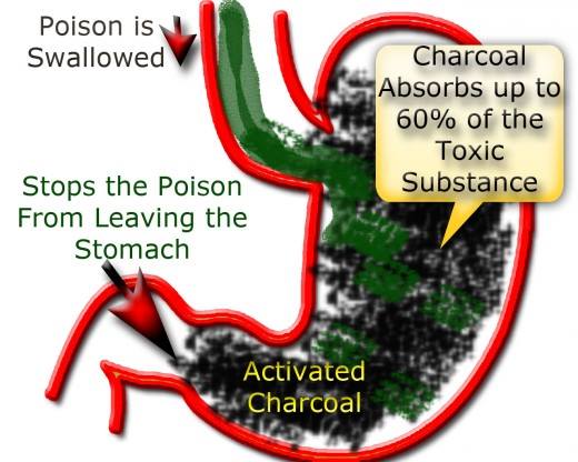 activated charcoal